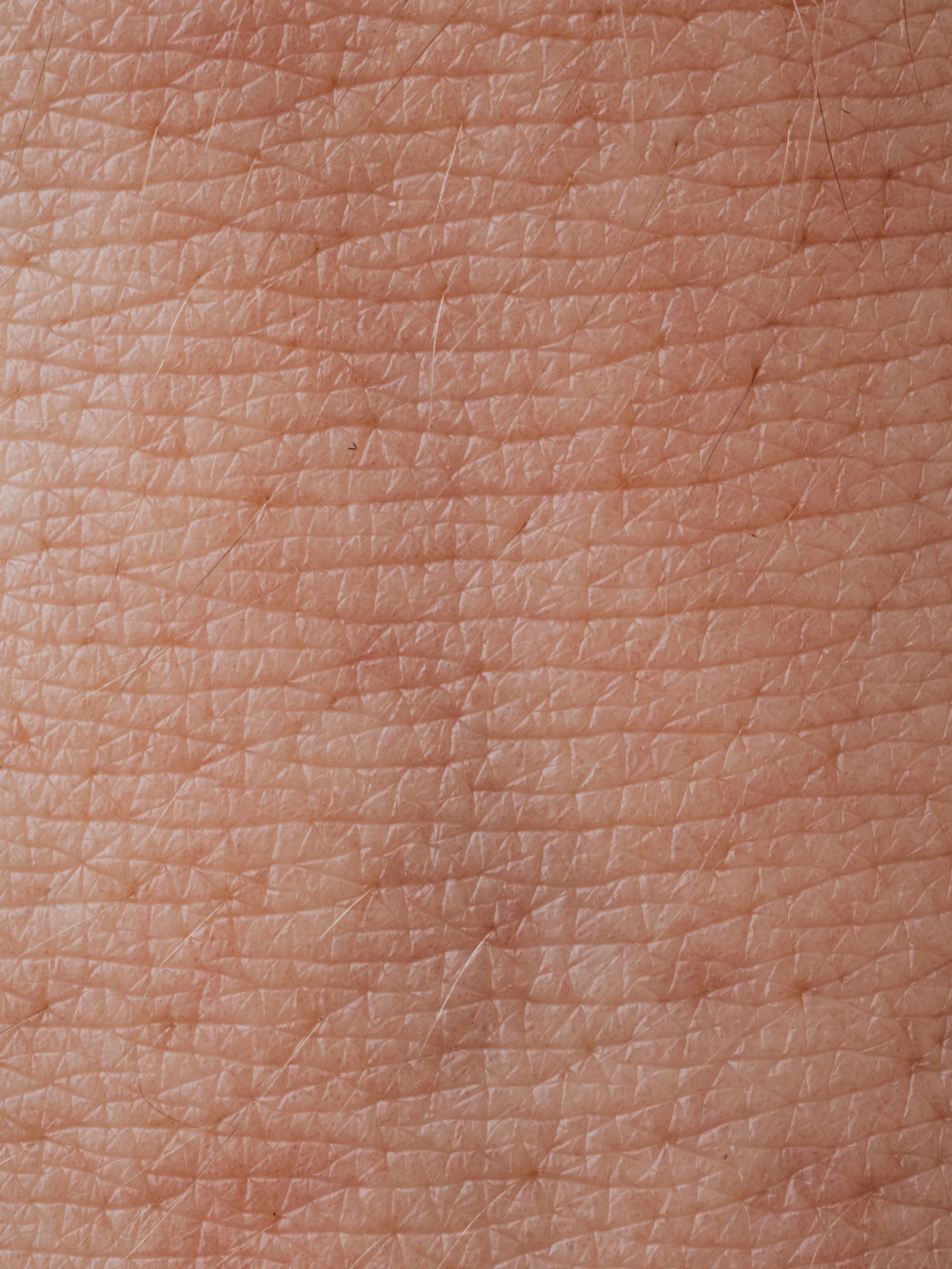 Endotoxins in cosmetics