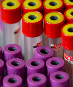 Lipopolysaccharide Quality Control