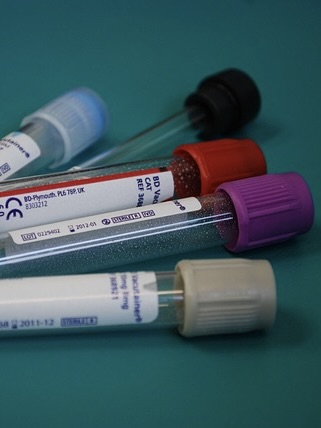 In Vitro Diagnostics development