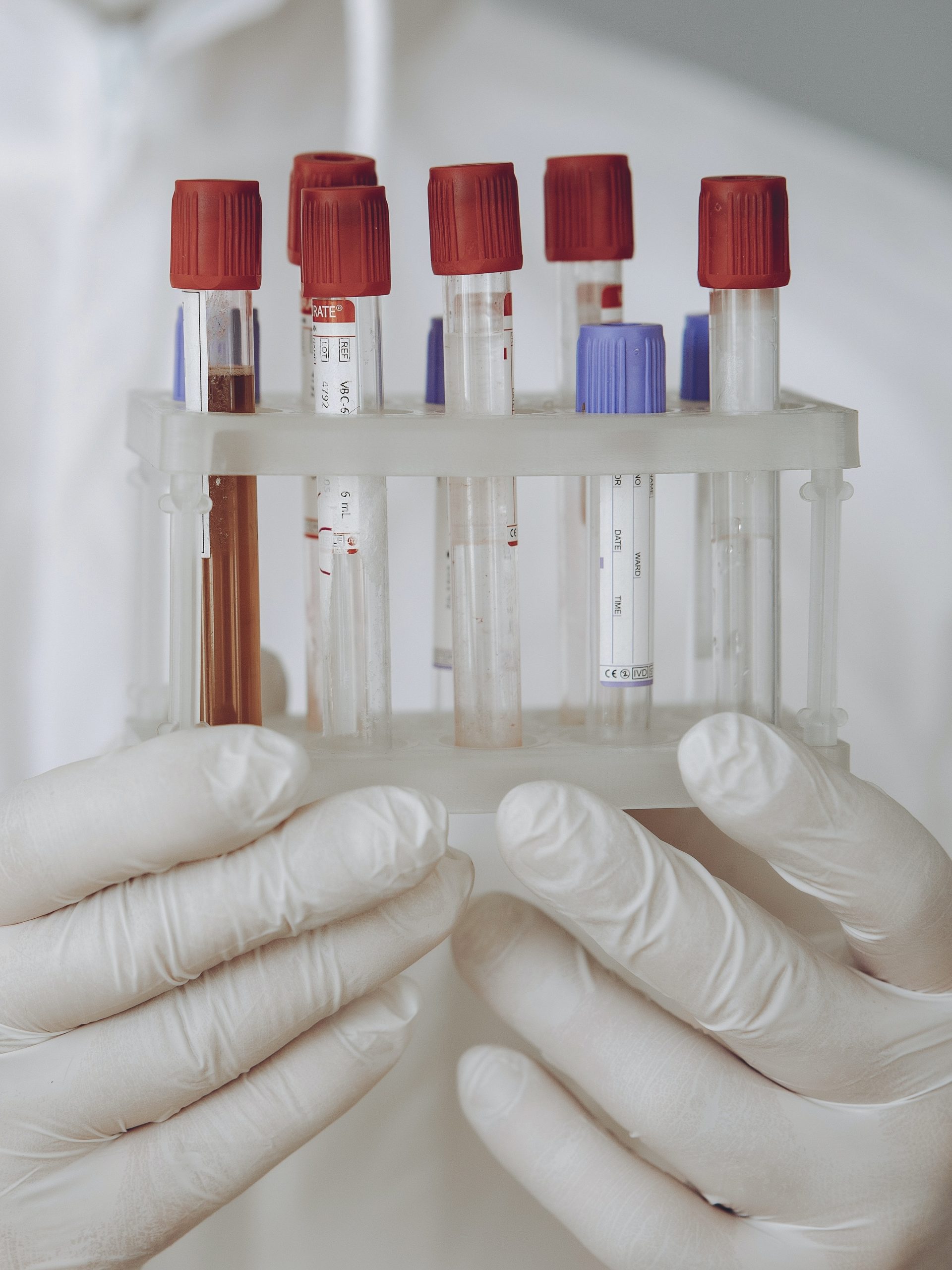 Interactions between medical device and endotoxins