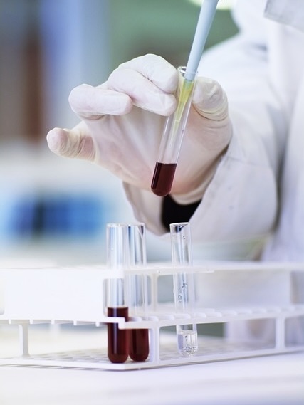 Endotoxins validity assays for quality control
